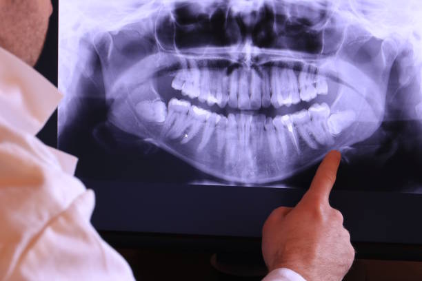 Best Emergency Dental Care for Broken or Chipped Teeth in Homer, IL